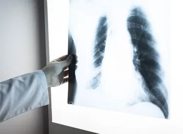 Sigara akciğere kızgın bir iğnenin batması gibi zarar veriyor