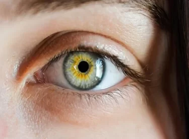 Göz kuruluğuna ne iyi gelir kalorifer peteğinizin üstüne su koyarsanız…