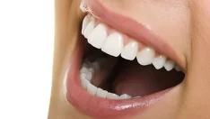 Ortodontik diş tedavisinde yeni yöntem: Telsiz ortodonti