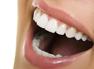 Ortodontik diş tedavisinde yeni yöntem: Telsiz ortodonti