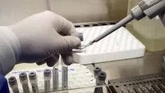 Sinekler ve hamam böcekleri koronavirüs taşır mı? Profesör açıkladı