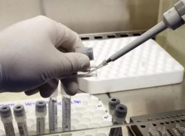 Sinekler ve hamam böcekleri koronavirüs taşır mı? Profesör açıkladı