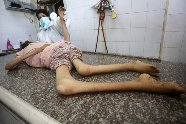 Gazze'de açlık nedeniyle ölümlersürüyor! Bir kız çocuğu hayatını kaybetti - Resim: 0